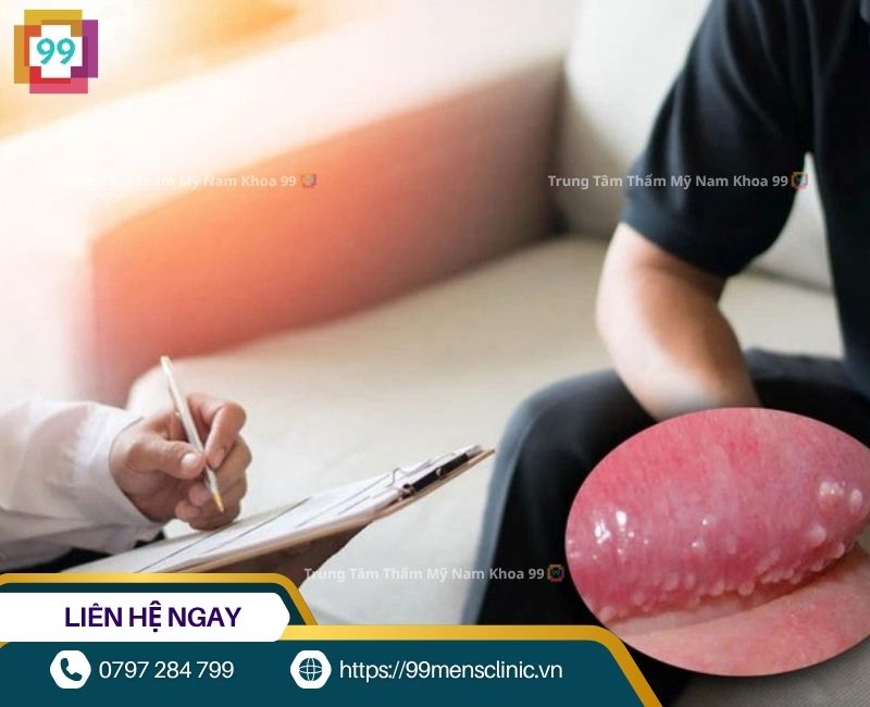 Chuỗi hạt ngọc dương vật có gây nguy hiểm không