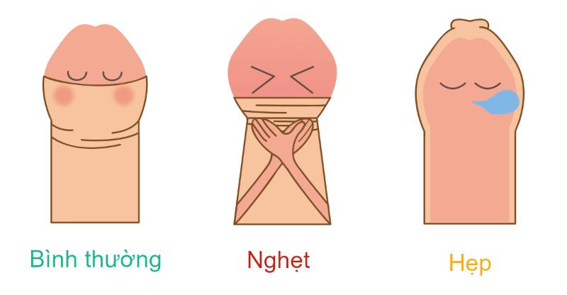 Khi bị nghẹt bao quy đầu sẽ không thể kéo hoàn toàn về phía trước