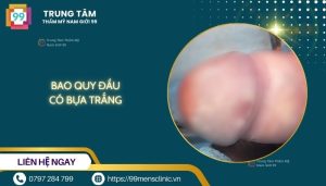 Bao quy đầu có bựa trắng