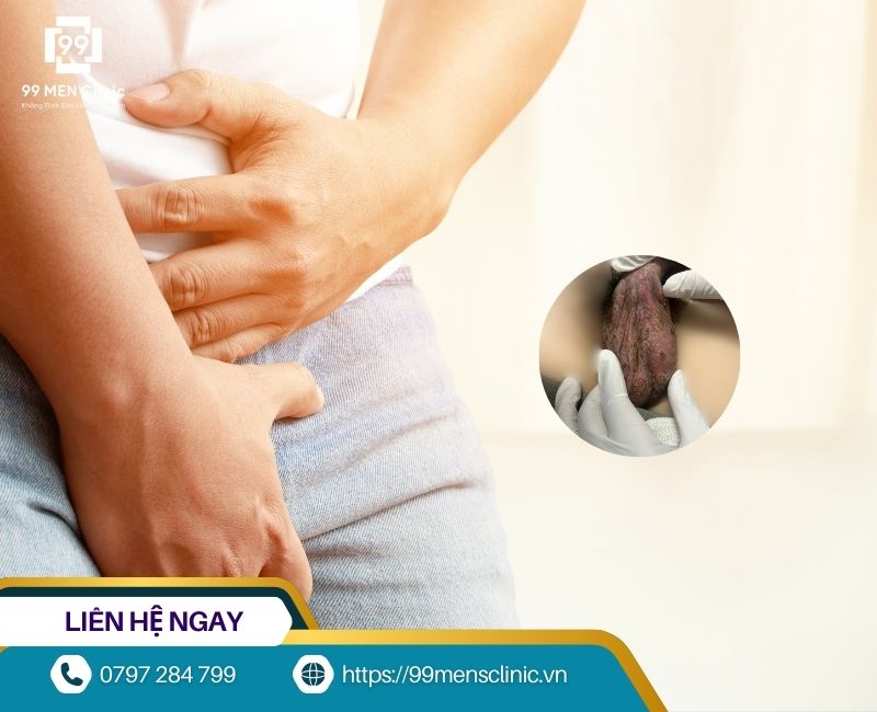 Nguyên nhân gây viêm da bìu ở nam giới