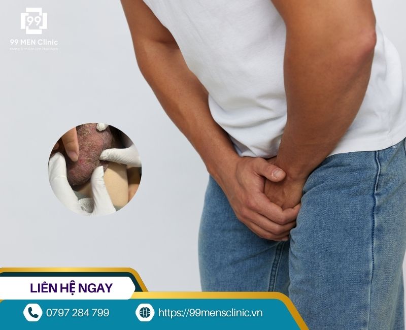 Triệu chứng nhận biết viêm da bìu